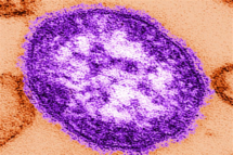 MeaslesVirus(Verbatim).png
